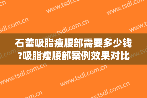 石蕾吸脂瘦腰部需要多少钱?吸脂瘦腰部案例效果对比图_中国医学科学院整形外科医院