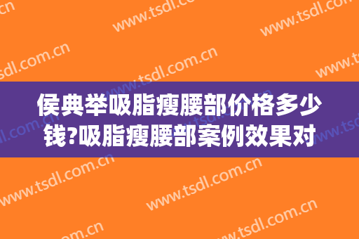 侯典举吸脂瘦腰部价格多少钱?吸脂瘦腰部案例效果对比图_中国医学科学院整形外科医院