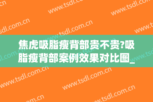 焦虎吸脂瘦背部贵不贵?吸脂瘦背部案例效果对比图_中国医学科学院整形外科医院