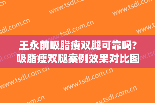 王永前吸脂瘦双腿可靠吗?吸脂瘦双腿案例效果对比图_中国医学科学院整形外科医院