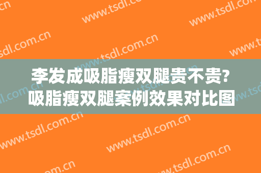 李发成吸脂瘦双腿贵不贵?吸脂瘦双腿案例效果对比图_中国医学科学院整形外科医院