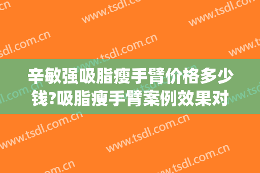 辛敏强吸脂瘦手臂价格多少钱?吸脂瘦手臂案例效果对比图_中国医学科学院整形外科医院