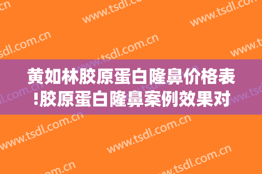 黄如林胶原蛋白隆鼻价格表!胶原蛋白隆鼻案例效果对比图_上海交通大学医学院附属第九人民医院