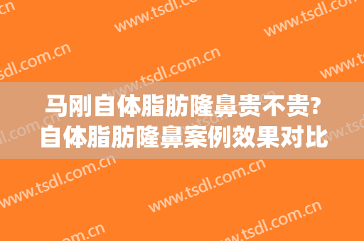 马刚自体脂肪隆鼻贵不贵?自体脂肪隆鼻案例效果对比图_上海交通大学医学院附属第九人民医院