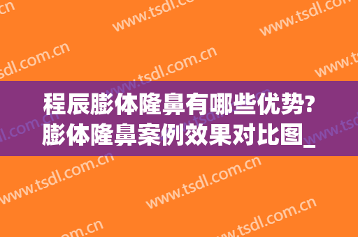 程辰膨体隆鼻有哪些优势?膨体隆鼻案例效果对比图_上海交通大学医学院附属第九人民医院
