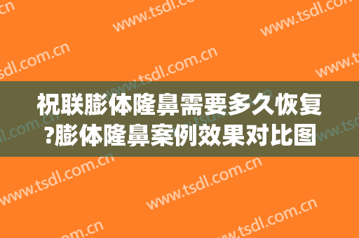 祝联膨体隆鼻需要多久恢复?膨体隆鼻案例效果对比图_上海交通大学医学院附属第九人民医院