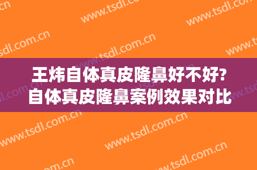 王炜自体真皮隆鼻好不好?自体真皮隆鼻案例效果对比图_上海交通大学医学院附属第九人民医院