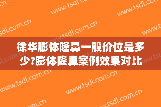 徐华膨体隆鼻一般价位是多少?膨体隆鼻案例效果对比图_上海交通大学医学院附属第九人民医院