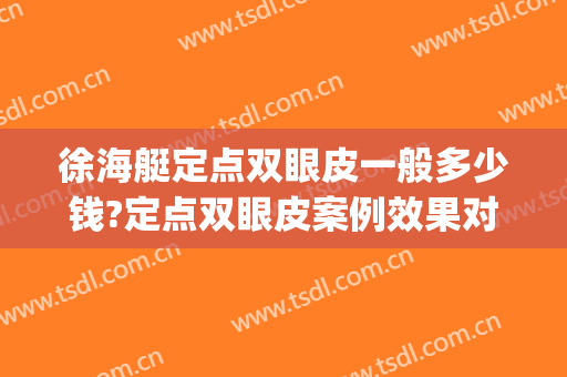 徐海艇定点双眼皮一般多少钱?定点双眼皮案例效果对比图_温州医科大学附属第二医院