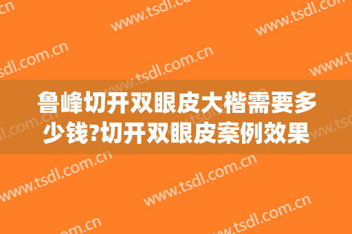 鲁峰切开双眼皮大楷需要多少钱?切开双眼皮案例效果对比图_南方医科大学南方医院