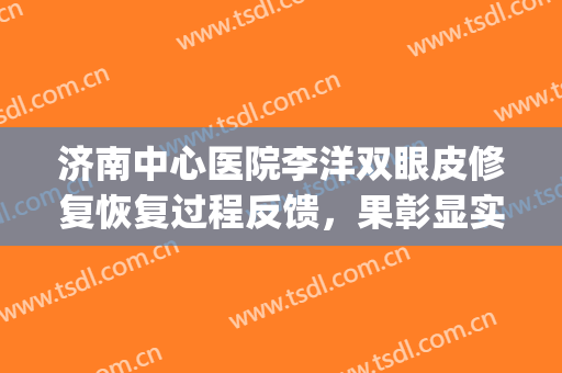 济南中心医院李洋双眼皮修复恢复过程反馈，果彰显实力(李高峰双眼皮修复)