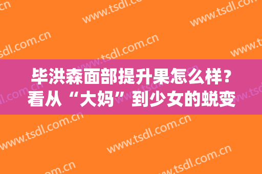 毕洪森面部提升果怎么样？看从“大妈”到少女的蜕变(毕洪森面部提升图片)