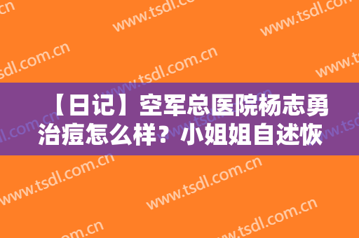 【日记】空军总医院杨志勇治痘怎么样？小姐姐自述恢复过程