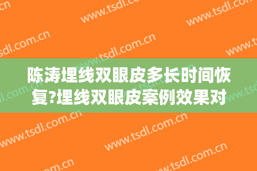 陈涛埋线双眼皮多长时间恢复?埋线双眼皮案例效果对比图_首都医科大学附属北京同仁医院