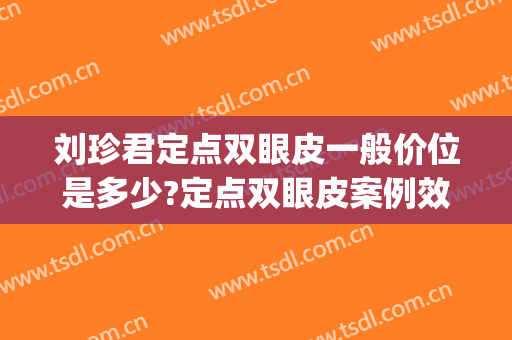 刘珍君定点双眼皮一般价位是多少?定点双眼皮案例效果对比图_中国医学科学院整形外科医院