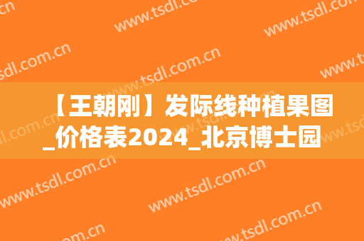 【王朝刚】发际线种植果图_价格表2024_北京博士园推荐专家
