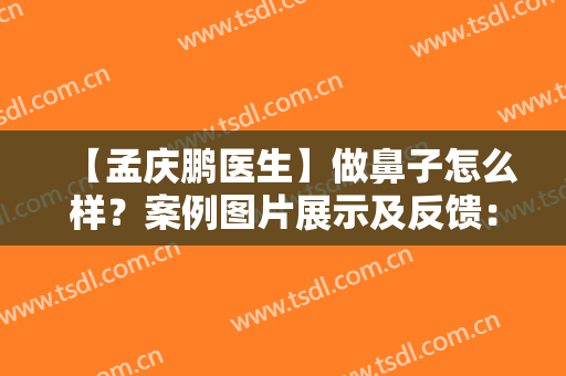 【孟庆鹏医生】做鼻子怎么样？案例图片展示及反馈：鼻子王名副其实！