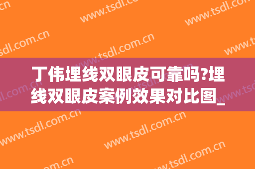 丁伟埋线双眼皮可靠吗?埋线双眼皮案例效果对比图_上海交通大学医学院附属第九人民医院