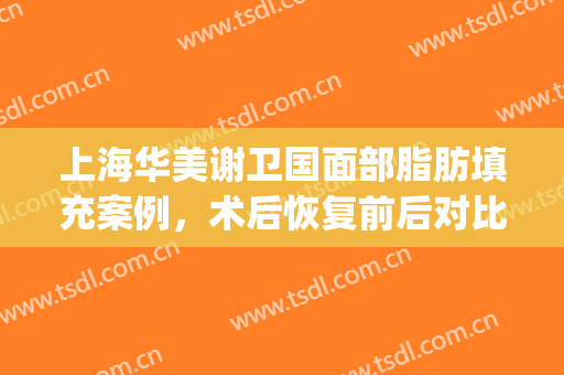 上海华美谢卫国面部脂肪填充案例，术后恢复前后对比展示(广州华美面部脂肪填充专家)