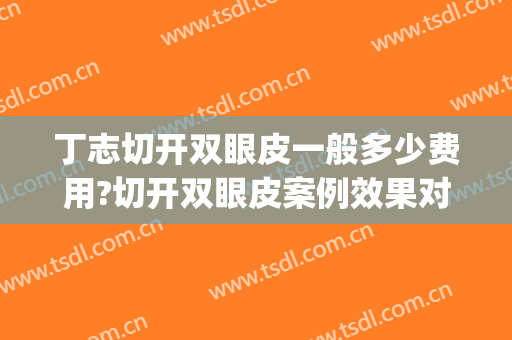 丁志切开双眼皮一般多少费用?切开双眼皮案例效果对比图_复旦大学附属华山医院