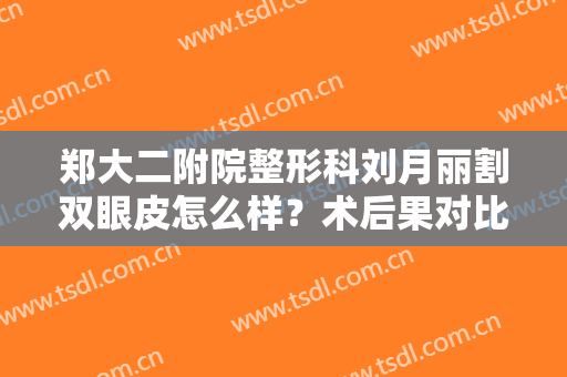 郑大二附院整形科刘月丽割双眼皮怎么样？术后果对比图及眼部整形价格查询