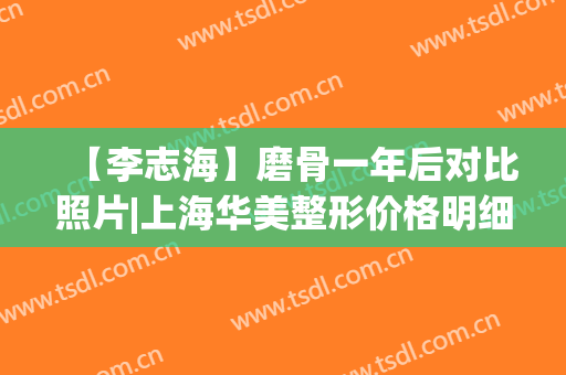 【李志海】磨骨一年后对比照片|上海华美整形价格明细(李志海磨骨效果好吗)