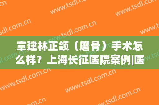 章建林正颌（磨骨）手术怎么样？上海长征医院案例|医生简介