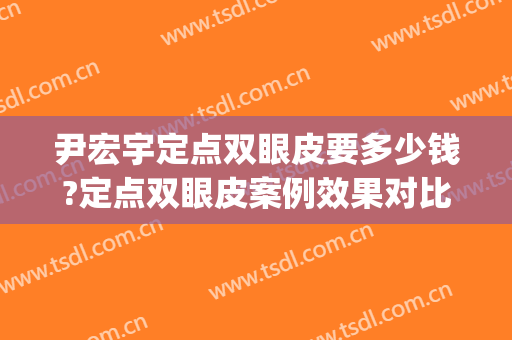尹宏宇定点双眼皮要多少钱?定点双眼皮案例效果对比图_首都医科大学附属北京世纪坛医院