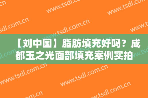 【刘中国】脂肪填充好吗？成都玉之光面部填充案例实拍图及价格明细展示