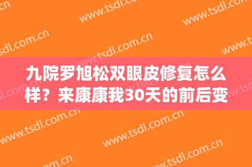 九院罗旭松双眼皮修复怎么样？来康康我30天的前后变化(九院罗旭松双眼皮修复案例)