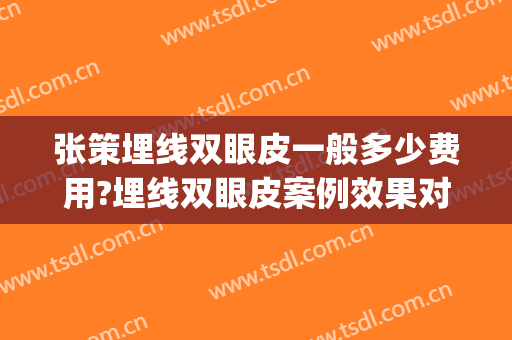 张策埋线双眼皮一般多少费用?埋线双眼皮案例效果对比图_浙江省人民医院