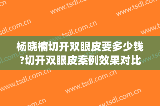 杨晓楠切开双眼皮要多少钱?切开双眼皮案例效果对比图_中国医学科学院整形外科医院
