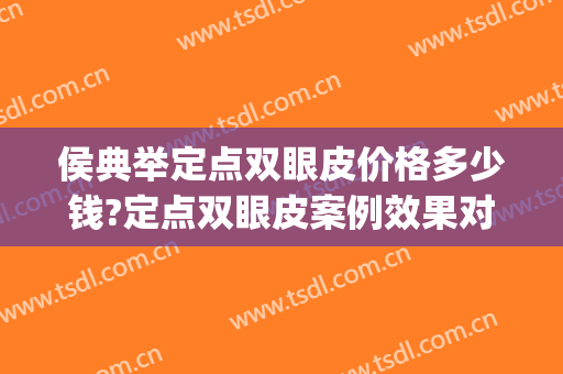 侯典举定点双眼皮价格多少钱?定点双眼皮案例效果对比图_中国医学科学院整形外科医院