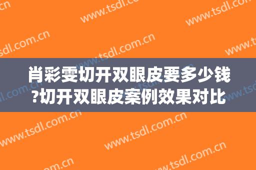 肖彩雯切开双眼皮要多少钱?切开双眼皮案例效果对比图_上海交通大学医学院附属第九人民医院