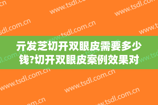 亓发芝切开双眼皮需要多少钱?切开双眼皮案例效果对比图_复旦大学附属中山医院