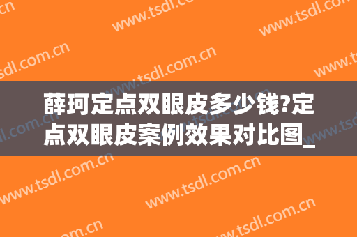 薛珂定点双眼皮多少钱?定点双眼皮案例效果对比图_上海交通大学医学院附属第九人民医院