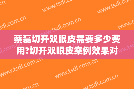 蔡磊切开双眼皮需要多少费用?切开双眼皮案例效果对比图_中国医学科学院整形外科医院