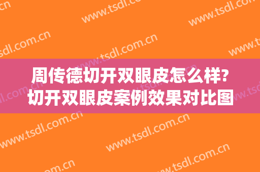 周传德切开双眼皮怎么样?切开双眼皮案例效果对比图_中国医学科学院整形外科医院