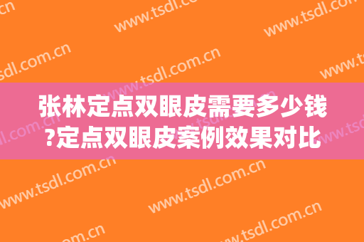 张林定点双眼皮需要多少钱?定点双眼皮案例效果对比图_安徽医科大学第一附属医院
