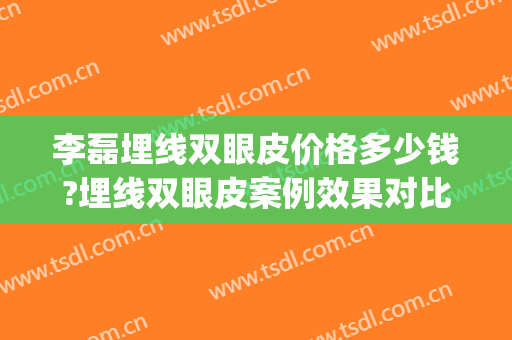 李磊埋线双眼皮价格多少钱?埋线双眼皮案例效果对比图_海南省人民医院