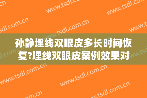 孙静埋线双眼皮多长时间恢复?埋线双眼皮案例效果对比图_上海交通大学医学院附属第九人民医院
