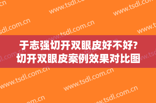 于志强切开双眼皮好不好?切开双眼皮案例效果对比图_复旦大学附属眼耳鼻喉科医院