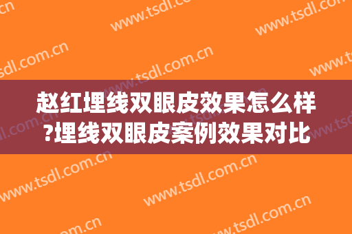 赵红埋线双眼皮效果怎么样?埋线双眼皮案例效果对比图_天津市眼科医院