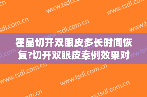 霍晶切开双眼皮多长时间恢复?切开双眼皮案例效果对比图_天津市公安医院