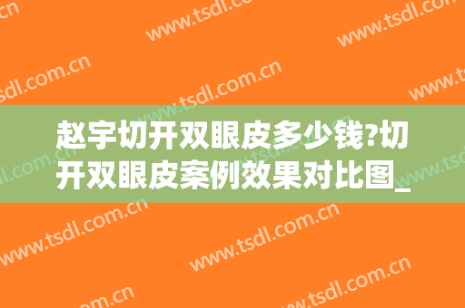 赵宇切开双眼皮多少钱?切开双眼皮案例效果对比图_安徽医科大学第一附属医院