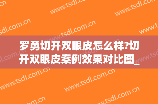 罗勇切开双眼皮怎么样?切开双眼皮案例效果对比图_南方医科大学南方医院