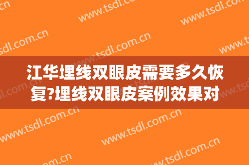 江华埋线双眼皮需要多久恢复?埋线双眼皮案例效果对比图_上海市东方医院