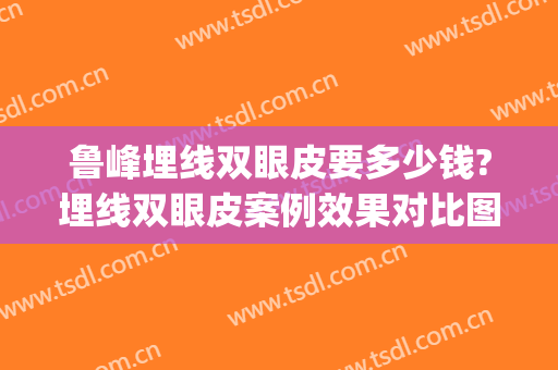 鲁峰埋线双眼皮要多少钱?埋线双眼皮案例效果对比图_南方医科大学南方医院
