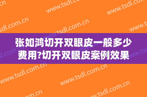 张如鸿切开双眼皮一般多少费用?切开双眼皮案例效果对比图_上海交通大学医学院附属第九人民医院