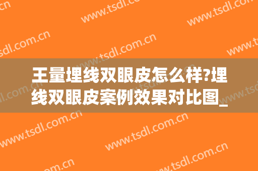 王量埋线双眼皮怎么样?埋线双眼皮案例效果对比图_重庆市南岸区中西医结合医院